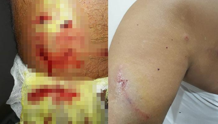 Antalya'da köpeklerin saldırısına uğrayan adam kanlar içinde  yere yığıldı