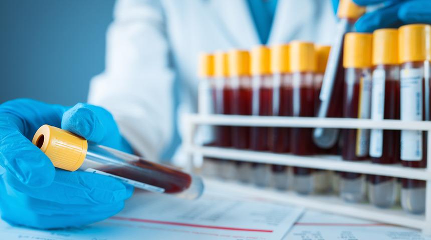 Genetik test nedir? Tüp bebek tedavisinde genetik tarama kimlere yapılır?