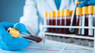 Genetik test nedir? Tüp bebek tedavisinde genetik tarama kimlere yapılır?