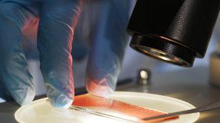 Koryon villus örneklemesi (CVS) testi ve amniyosentez testlerinin farkları nelerdir?