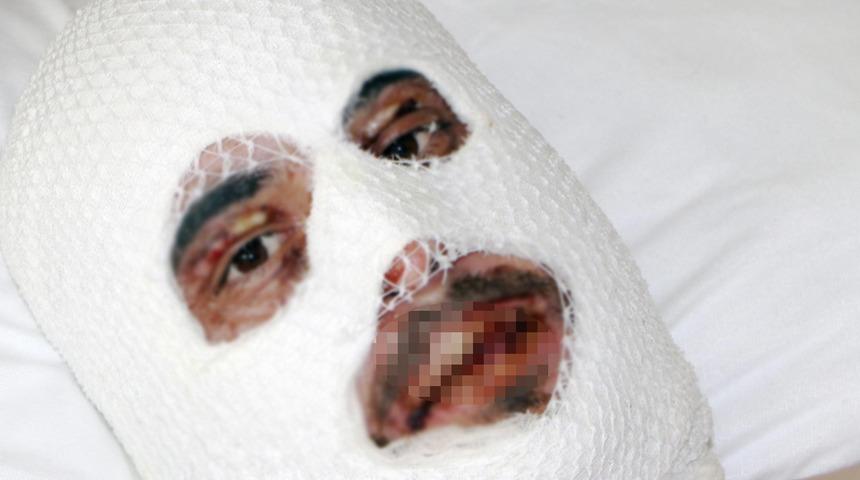 Son Dakika: Gittikleri kafede cehennemi yaşadılar! Alevler bir anda her yeri sardı, merdivende düşünce...