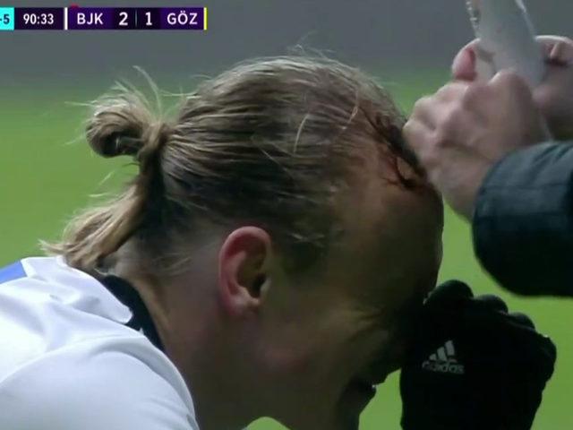 Son dakika: Beşiktaş-Göztepe maçında Vida korkuttu! Kanlar içinde yerde kaldı...