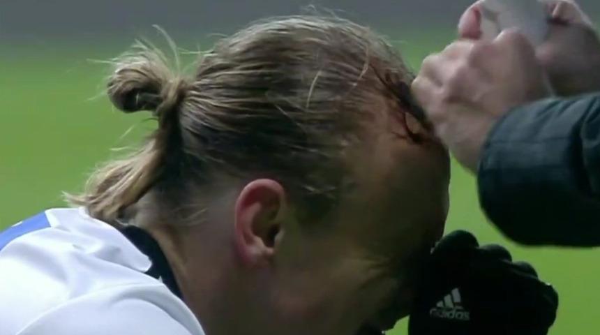 Son dakika: Beşiktaş-Göztepe maçında Vida korkuttu! Kanlar içinde yerde kaldı...