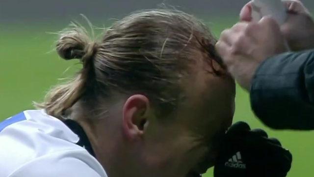 Son dakika: Beşiktaş-Göztepe maçında Vida korkuttu! Kanlar içinde yerde kaldı...