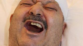 18 yıldır hayatı zindan oldu! 6 sağlam dişini çektirdi, gerçek bambaşka çıktı