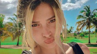 Survivor İlayda Şeker ''Çok merak ettiniz'' diyerek estetiksiz halini paylaştı!