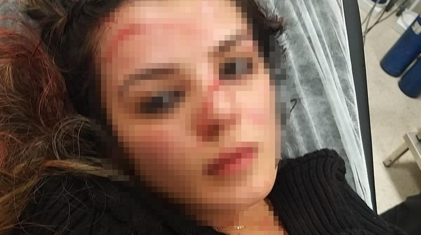 Son Dakika: Ayrıldığı eşini otele girerken görünce demir sopa ile dövüp, yüzünü bıçakla kesmişti! Yeni gelişme