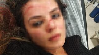 Son Dakika: Ayrıldığı eşini otele girerken görünce demir sopa ile dövüp, yüzünü bıçakla kesmişti! Yeni gelişme