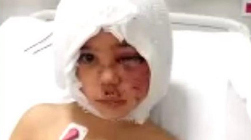 Son Dakika: Pitbull saldırısında yaralanan Asiye Ateş'e doku nakline başlandı