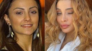 Özge Ulusoy'dan estetik açıklaması! Hiç korkmuyorum