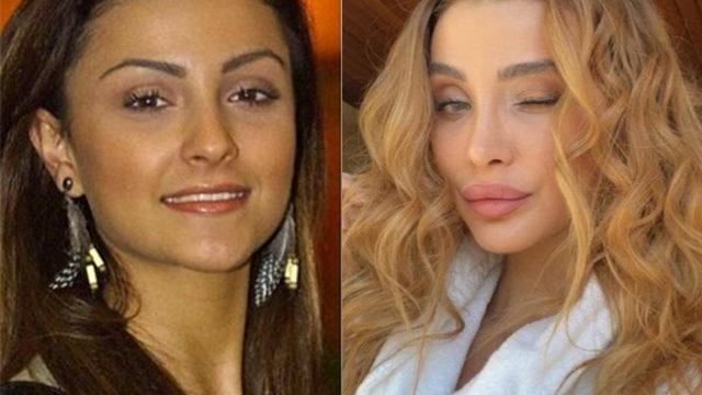 Özge Ulusoy'dan estetik açıklaması! Hiç korkmuyorum