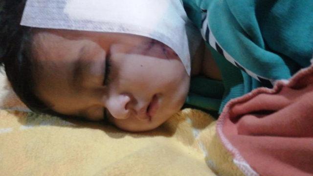 Son Dakika | Antalya'daki pitbull saldırısı! Sadrettin Kaçar'ın yanağı ve kulağı kopmuştu! 2,5 ay sonra çok acı detay...