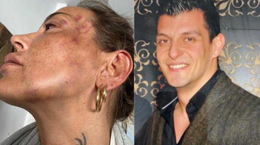 Son Dakika: 'Dayakçı sevgili' için mahkemeden flaş karar