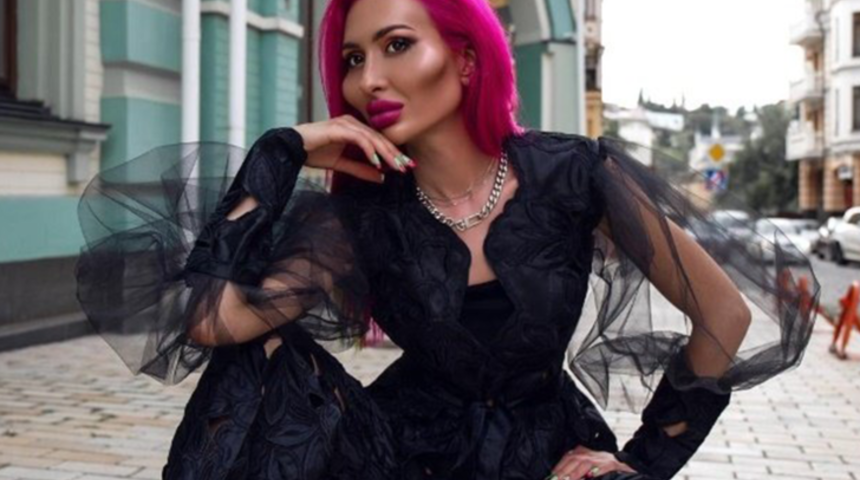 Dünyanın en büyük yanaklarına sahip olan modeli, üç yıl içinde yüzünün değişimi paylaştı