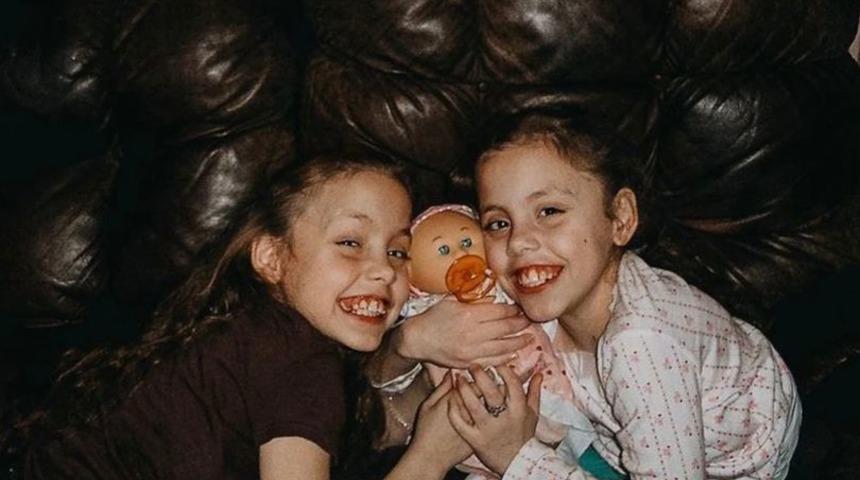 Yapışık ikiz kardeşi trajik bir şekilde ölünce hayatını ona adadı! Sosyal medyada paylaşımlarıyla viral oldu