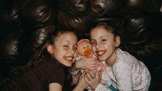 Yapışık ikiz kardeşi trajik bir şekilde ölünce hayatını ona adadı! Sosyal medyada paylaşımlarıyla viral oldu