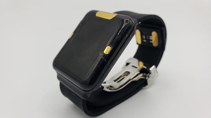 Bu akıllı saat, diyabet hastalarını parmak delmekten kurtaracak