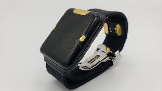 Bu akıllı saat, diyabet hastalarını parmak delmekten kurtaracak