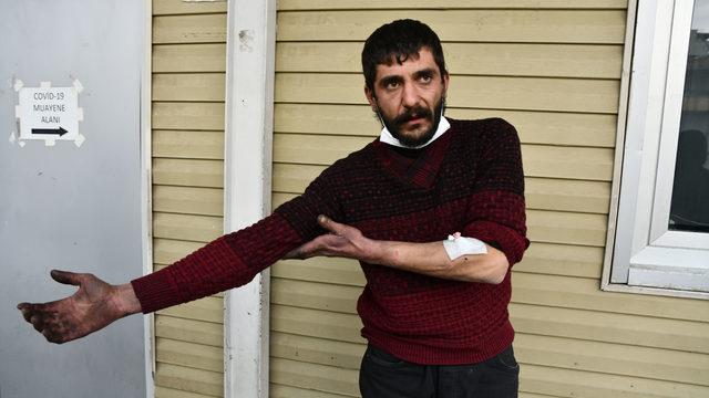 Son Dakika: Gaziantep'te bir pitbull dehşeti daha! 14 yerinden ısırdı