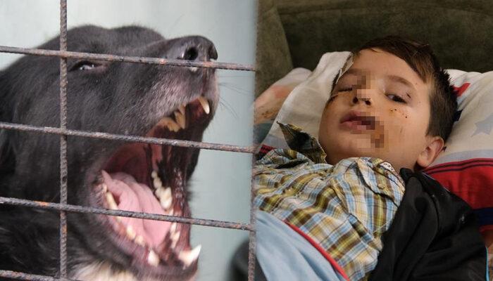 SON DAKİKA | Evinin önünde oynarken köpek saldırdı, yüzüne 60 dikiş atıldı! 8 yaşındaki Mert Dilek: Köpek görünce anne ve babamın arkasına saklanıyorum
