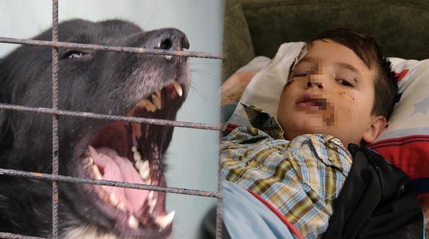SON DAKİKA | Evinin önünde oynarken köpek saldırdı, yüzüne 60 dikiş atıldı! 8 yaşındaki Mert Dilek: Köpek görünce anne ve babamın arkasına saklanıyorum