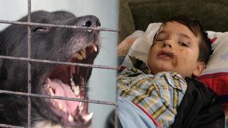 SON DAKİKA | Evinin önünde oynarken köpek saldırdı, yüzüne 60 dikiş atıldı! 8 yaşındaki Mert Dilek: Köpek görünce anne ve babamın arkasına saklanıyorum