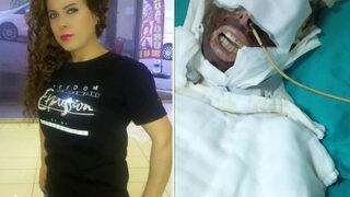 Son Dakika: Saplantılı aşıktan kimyasal maddeli saldırı! İstenen ceza belli oldu