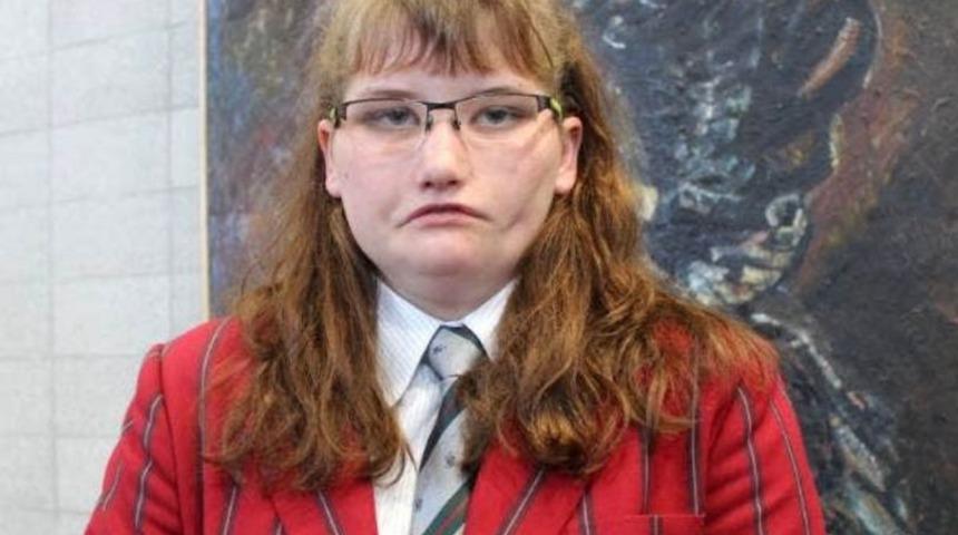 Nadir görülen bir hastalık nedeniyle zorbalığa uğradı! Hayatı boyunca gülmeyen Tayla Clement fenomen oldu