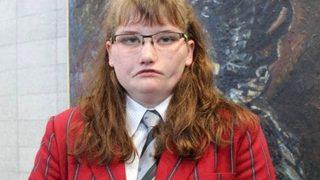 Nadir görülen bir hastalık nedeniyle zorbalığa uğradı! Hayatı boyunca gülmeyen Tayla Clement fenomen oldu