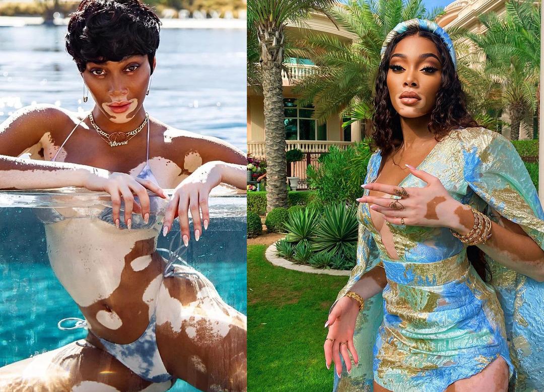 'T&uuml;rk lokumu' Winnie! Paylaşımı olay oldu 