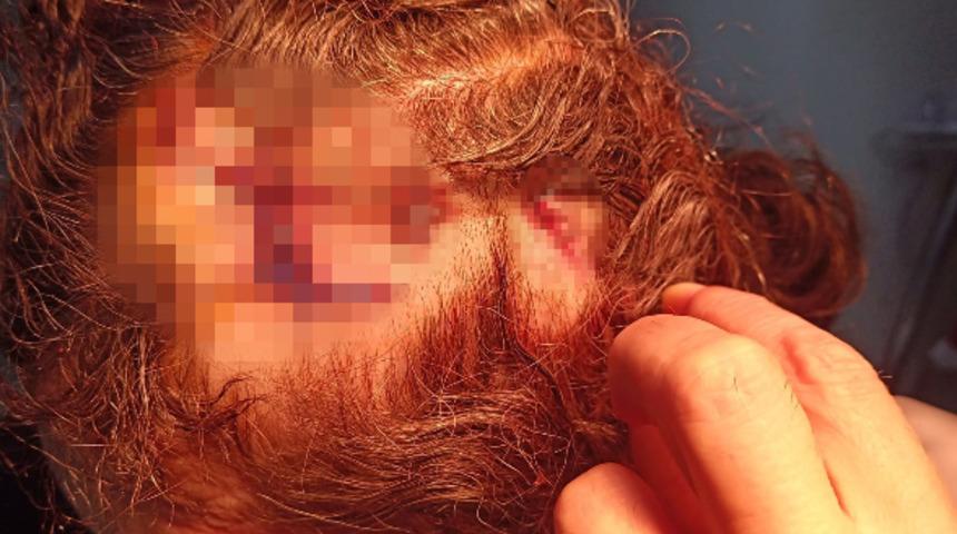 Küçükçekmece’de çekiçli saldırı dehşeti! ''Kafası tülbentle sarılı sürekli kafama vuruyordu''