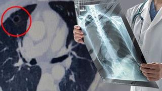 Koronavirüs geçirenlerin akciğerlerini güçlendiren nefes egzersizleri! 