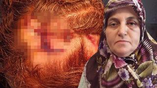 Yüzünü tülbentle kapatıp çekiçle saldırmıştı! Saldırgan bakın kim çıktı