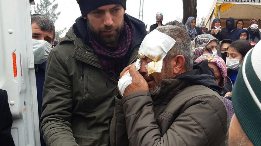 Bu acıya y&uuml;rek dayanmaz! Y&uuml;z&uuml; g&ouml;z&uuml; sargılı halde, karısının cenazesine geldi