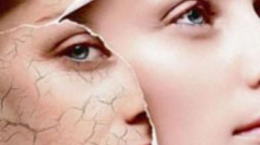 Kırışıklıklara Son!
