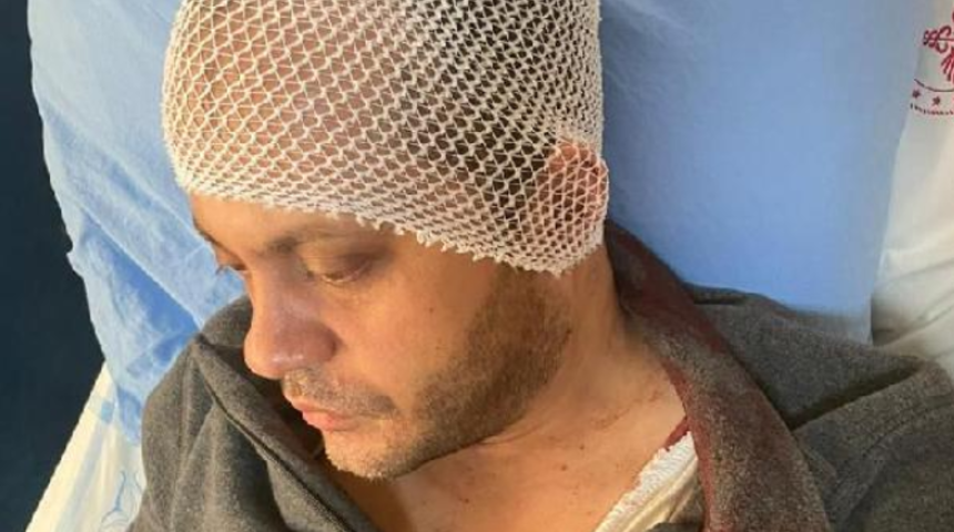 Gaziantep'te doktora mermerli saldırı! Randevusuz geldi, hasta yakını doktoru bu hale getirdi