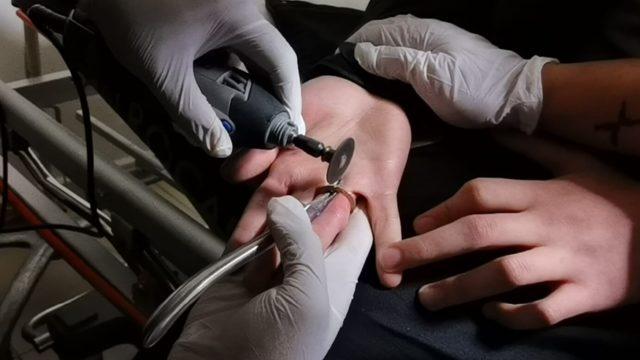 Bursa'da ilginç olay! Parmağına 1 TL sıkıştı, itfaiye ekipleri seferber oldu 