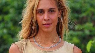 'Survivor Duygu'nun son hali şaşkına çevirdi! İşte Duygu Bal'ın son hali...