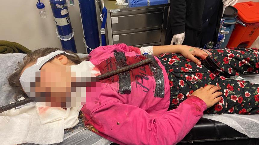 Son Dakika: Oyun oynadığı inşaatta dehşeti yaşadı! Küçük kızın boğazına demir çubuk saplandı