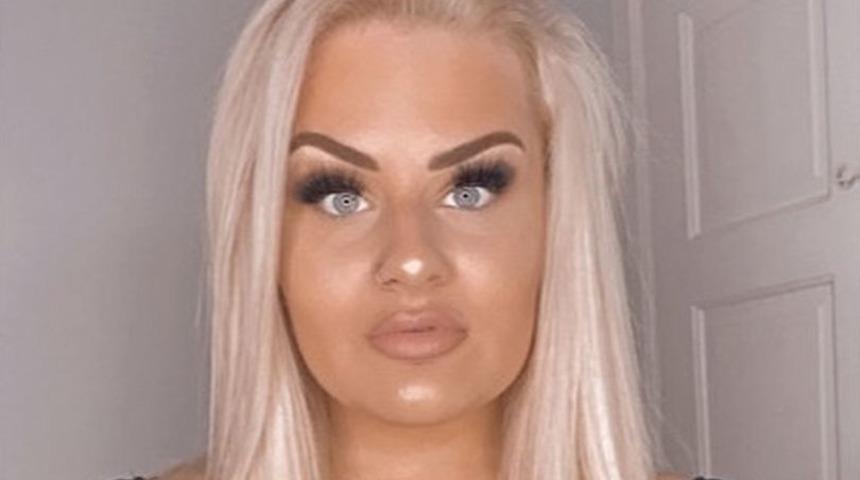 Estetik müdahalelerinden kurtulmak istedi, dolgularını çıkarttı! Gördüklerine inanamadı