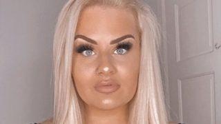 Estetik müdahalelerinden kurtulmak istedi, dolgularını çıkarttı! Gördüklerine inanamadı