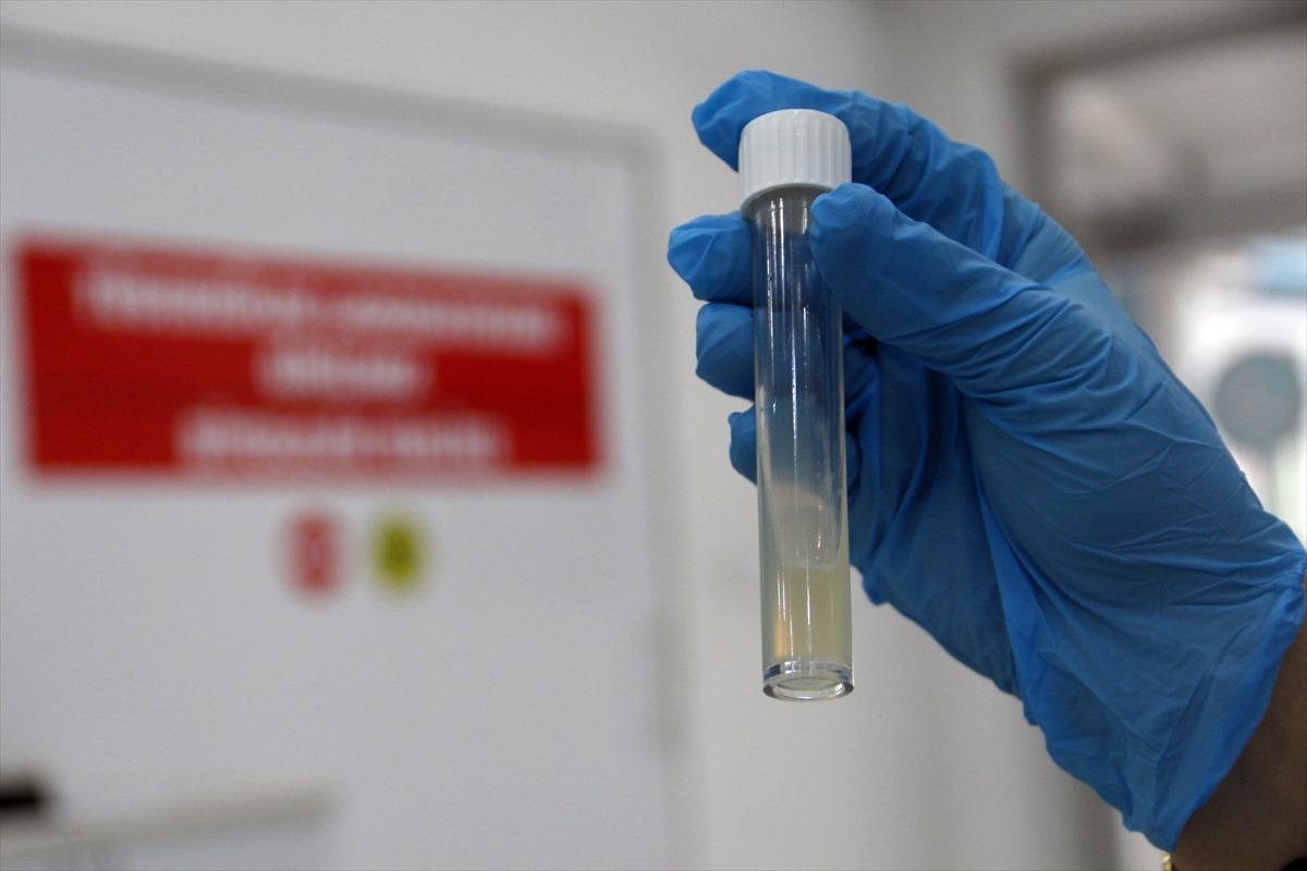 T&uuml;berk&uuml;lozda erken tanı s&uuml;recini hızlandıran yeni y&ouml;ntem kullanıma sunulacak