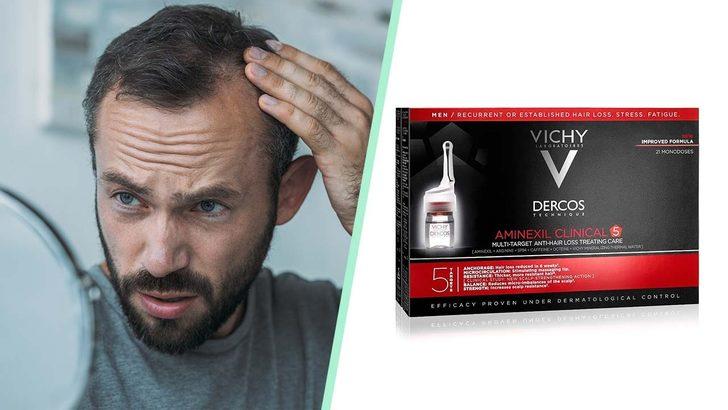 Erkeklerin artan saç dökülmesi sorununa karşı alabilecekleri önlemler ve ürün önerileri