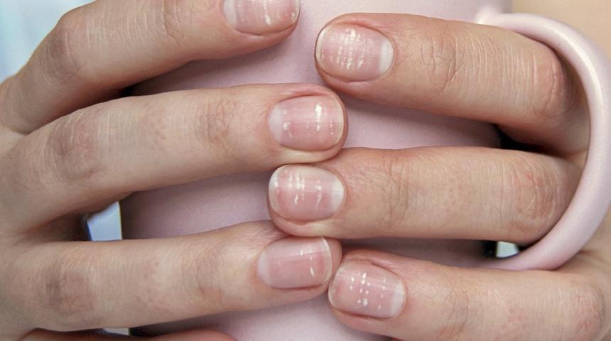 Eksikliği kısırlığa da kansere de neden olabilir! Çinko vücutta ne işe yarar? Çinko eksikliğinde ne olur? A’dan Z’ye Çinko rehberi