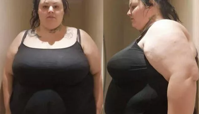 Hayatını tamamen değiştirdi! Fazla kilolarından şikayet eden Rebecca Wilkinson Türkiye’de bambaşka biri oldu