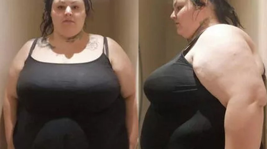 Hayatını tamamen değiştirdi! Fazla kilolarından şikayet eden Rebecca Wilkinson Türkiye’de bambaşka biri oldu