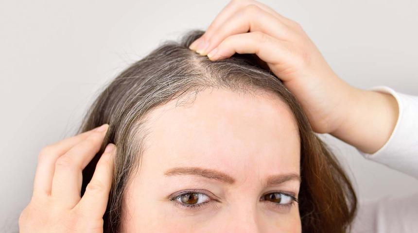 Beyaz saçları yok etmenin en doğal yolu! İşte mucizevi karışım