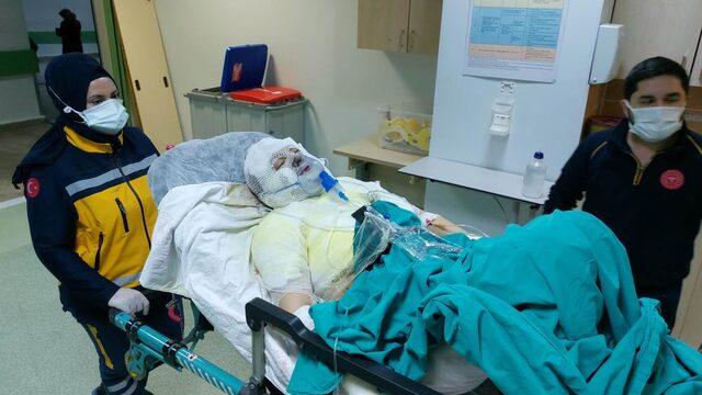 Ya benimsin ya toprağın dedi, boşandığı eşini yanıcı madde dökerek yaktı