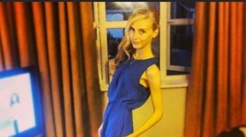 Neredeyse ölüyordu! Aneroksiya hastası kadın, yaşadıklarıyla ilham olmayı başardı