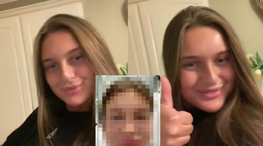 Dudak dolgusundan kurtulmak isteyen bir kadın, son haline inanamadı! Sosyal medyada popüler oldu